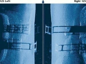 Side imaging vs Down Imaging for fish finders